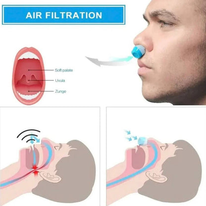 Portable Sleep Aid Device for Snoring and Apnea Relief