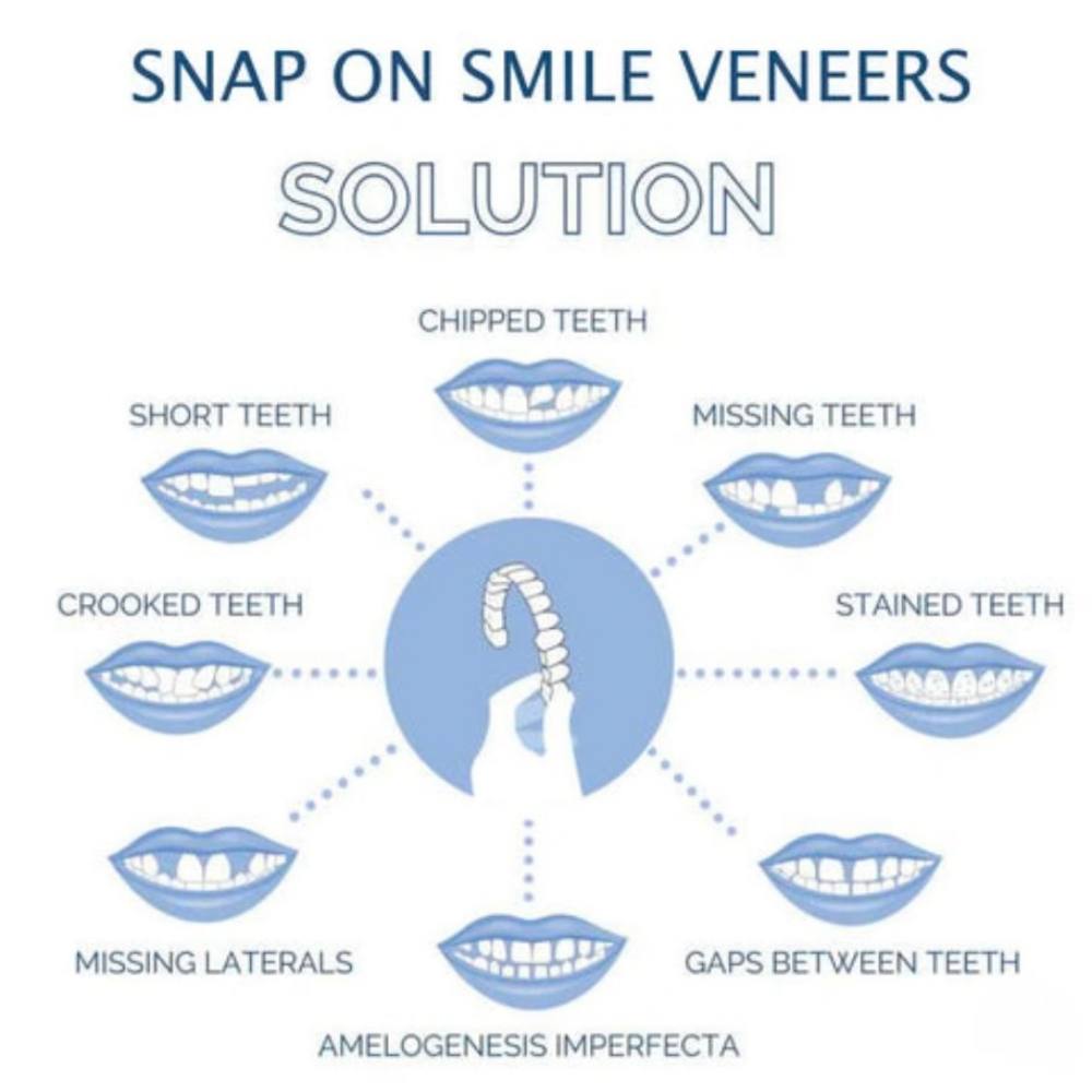 Instant Smile Enhancer for Upper and Lower Teeth