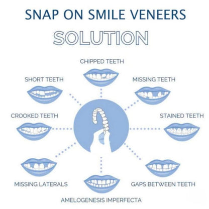 Instant Smile Enhancer for Upper and Lower Teeth