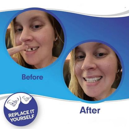 Instant Smile Enhancer for Upper and Lower Teeth