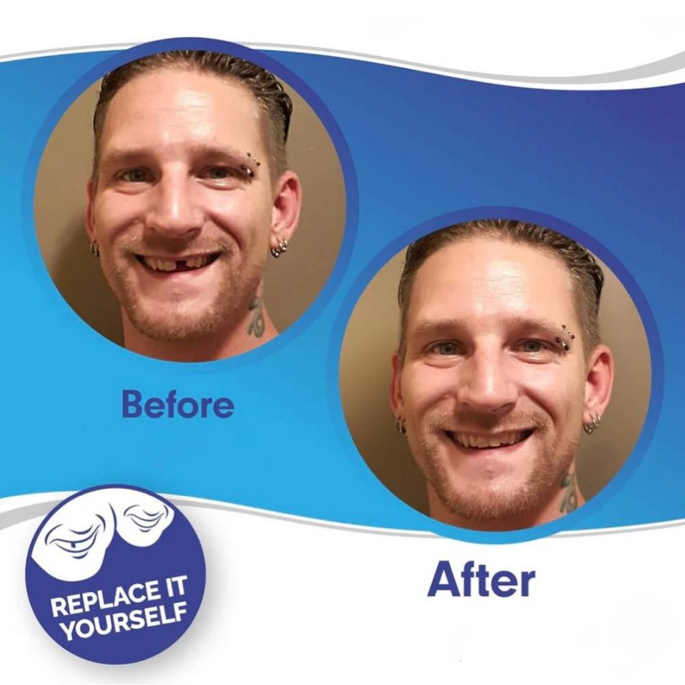 Instant Smile Enhancer for Upper and Lower Teeth